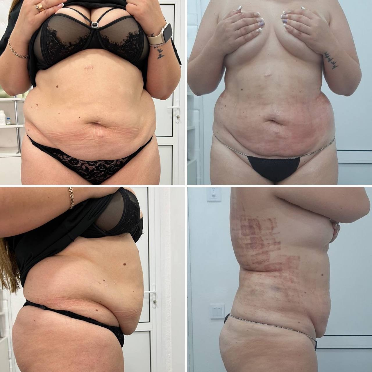 Что такое DSR?