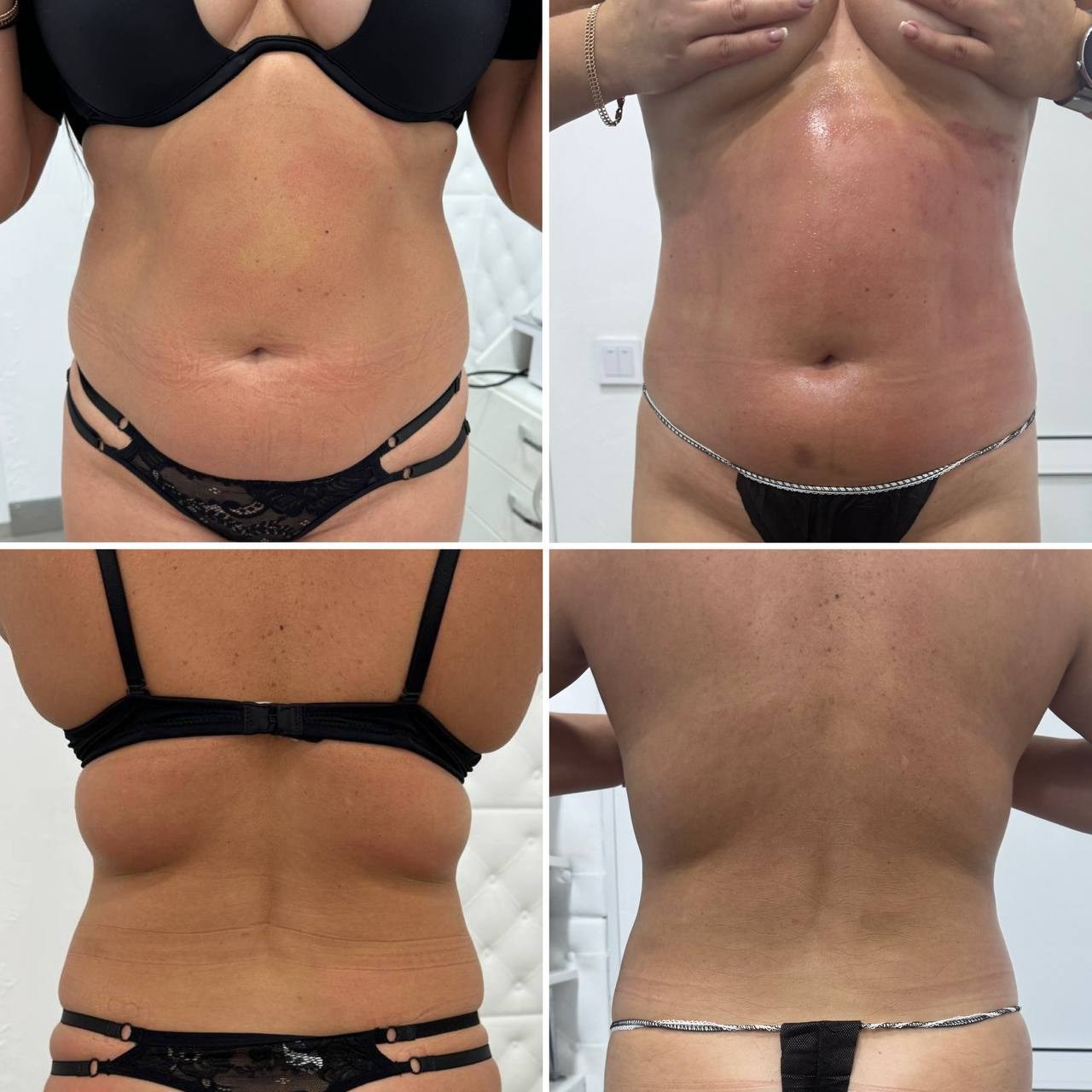 Что такое DSR?