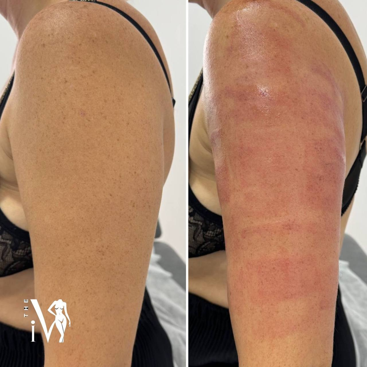 Что такое DSR?