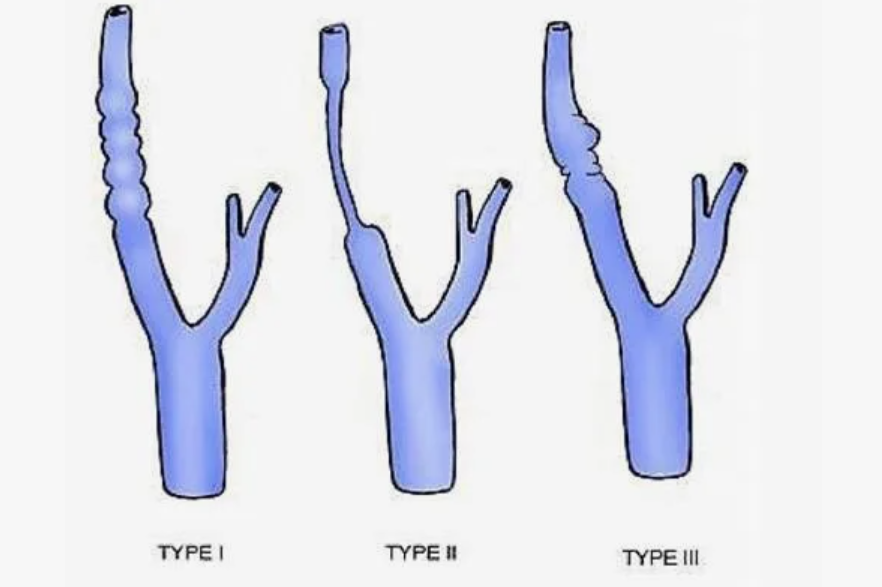 Бусы могут быть не только на шее, но и внутри нее. РЕНТГЕН КТ МРТ в Санкт-Петербурге Александра Лоншакова