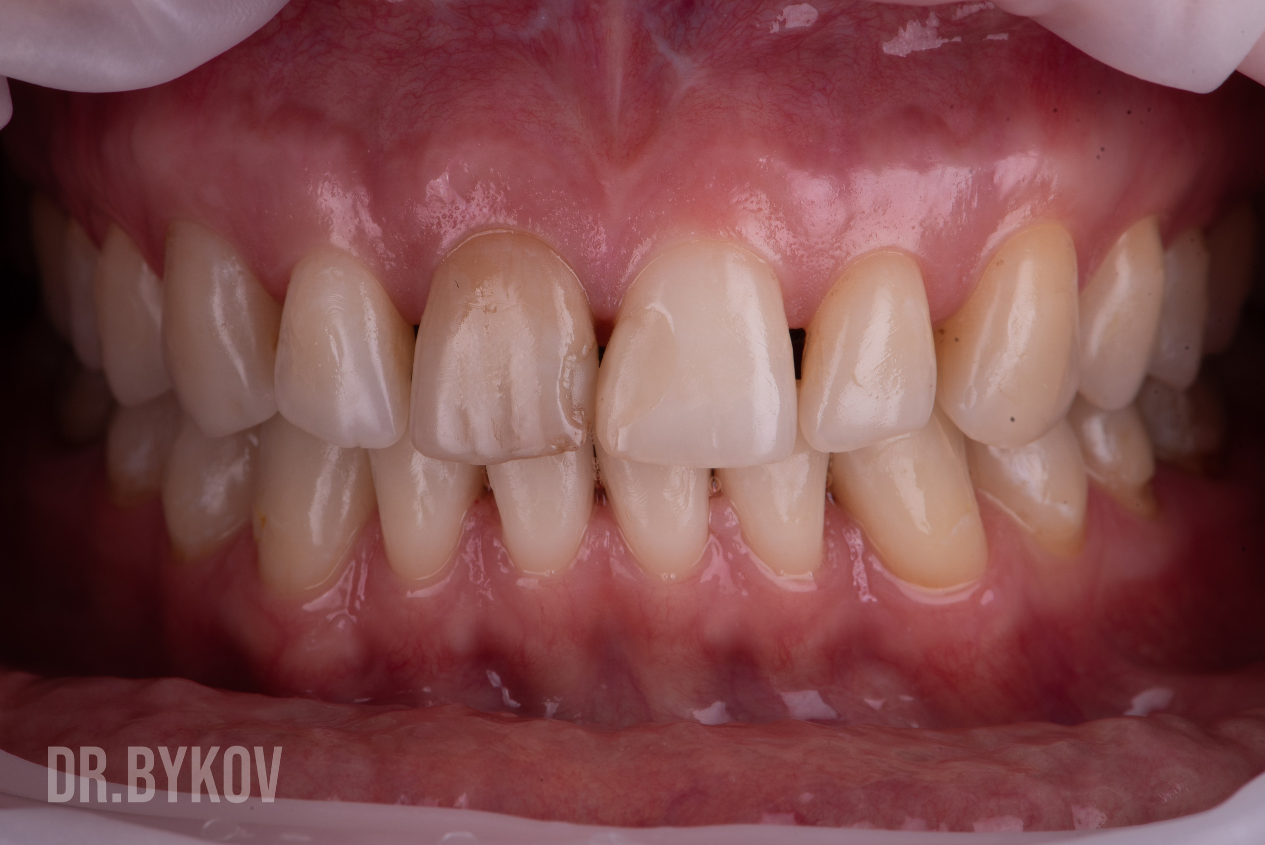 Портфолио. Врач стоматолог-ортопед Быков Алексей