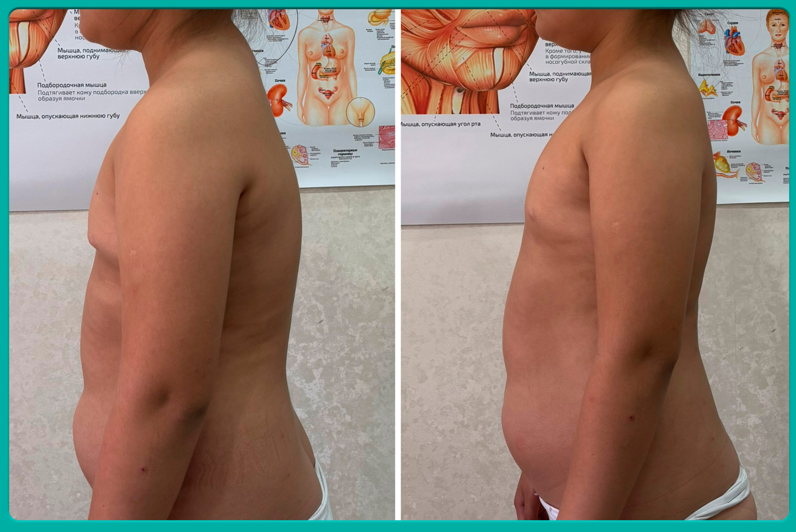 Результат. Моё предназначение — восстанавливать тело, помогать людям возвращать себя и своё истинное здоровье, и обучать других работать так же глубоко