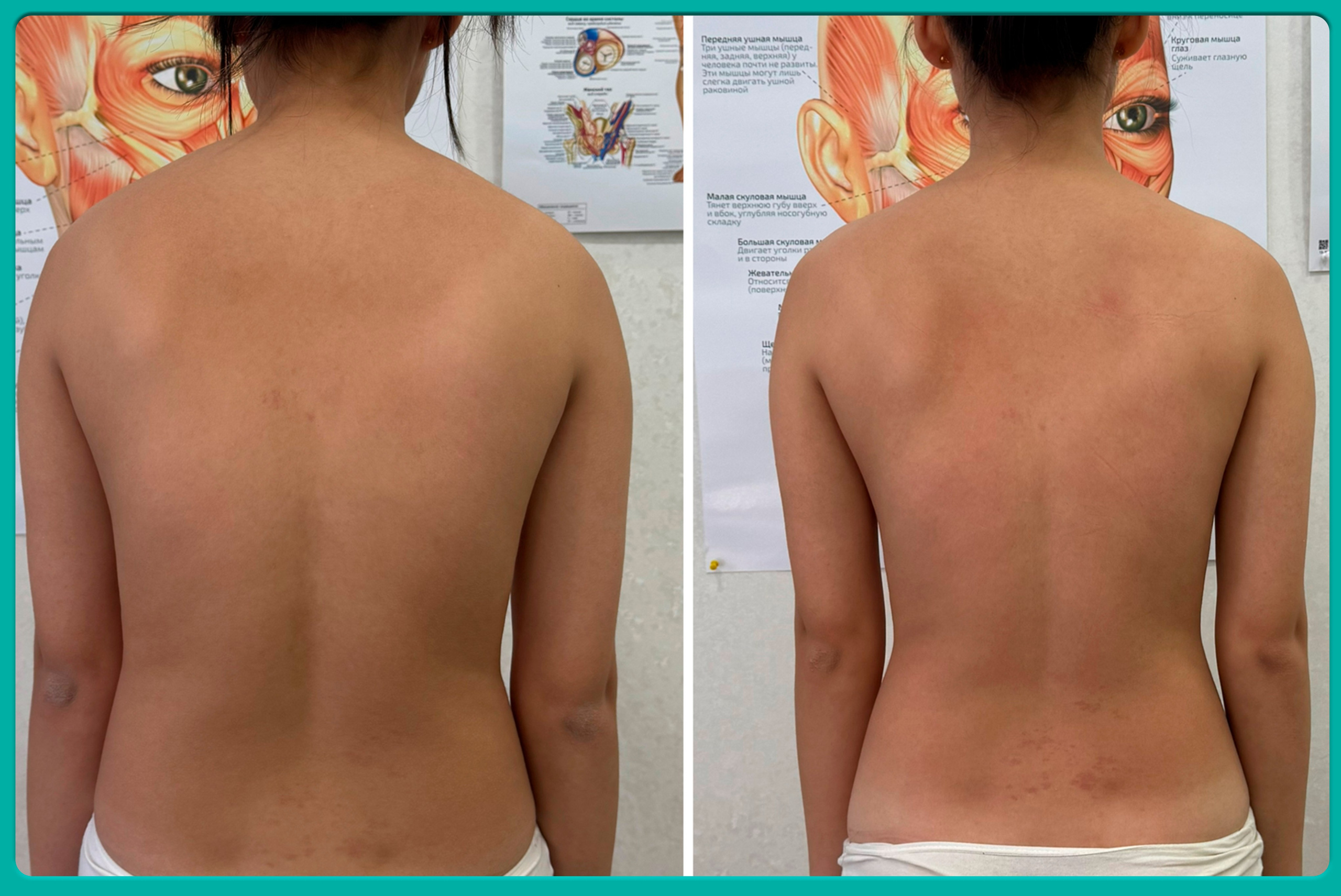 Результат. Моё предназначение — восстанавливать тело, помогать людям возвращать себя и своё истинное здоровье, и обучать других работать так же глубоко