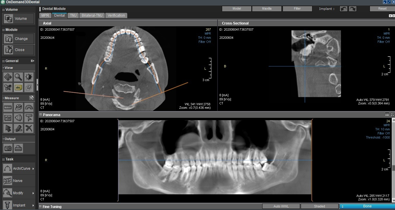 Стоимость диагностики. Стоматология «Ортодонт-Эстетик». Установка брекетов в Оренбурге, взрос