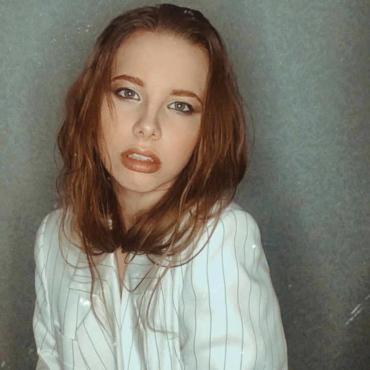 Результаты работ до/после и замечательные улыбки. Стоматология «Ортодонт-Эстетик». Установка брекетов в Оренбурге, взрос