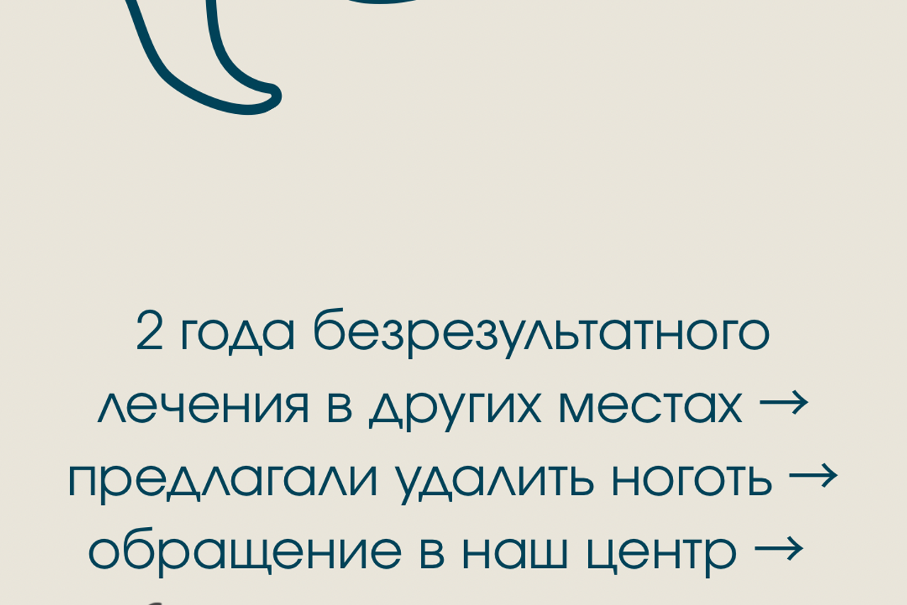 Обработка стопы при грибке. Подолог г. Хабаровск — центр здоровой стопы «FOOTTIME»