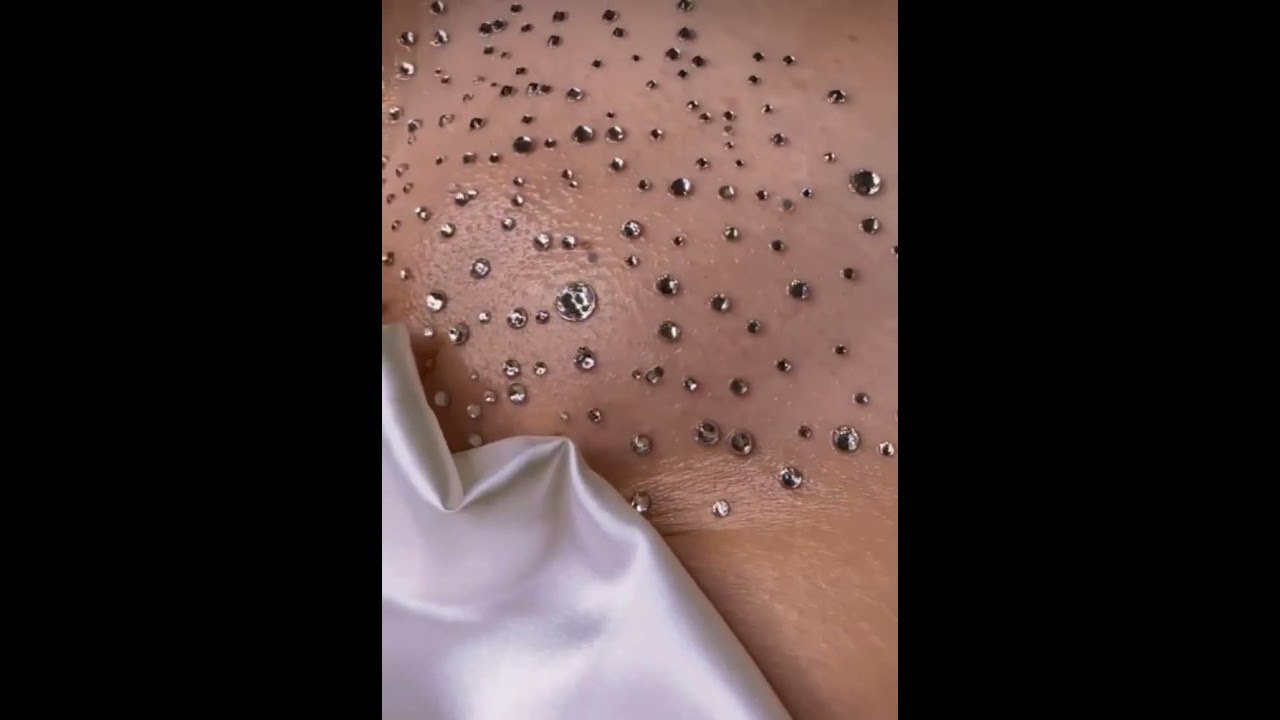 Видео. Лазерная эпиляция в г. Кемерово, г. Новокузнецке и г. Киселевске