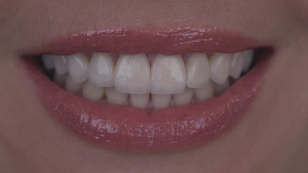 Ортопедия. Дентал фотограф — видеограф Денис Дорошенко