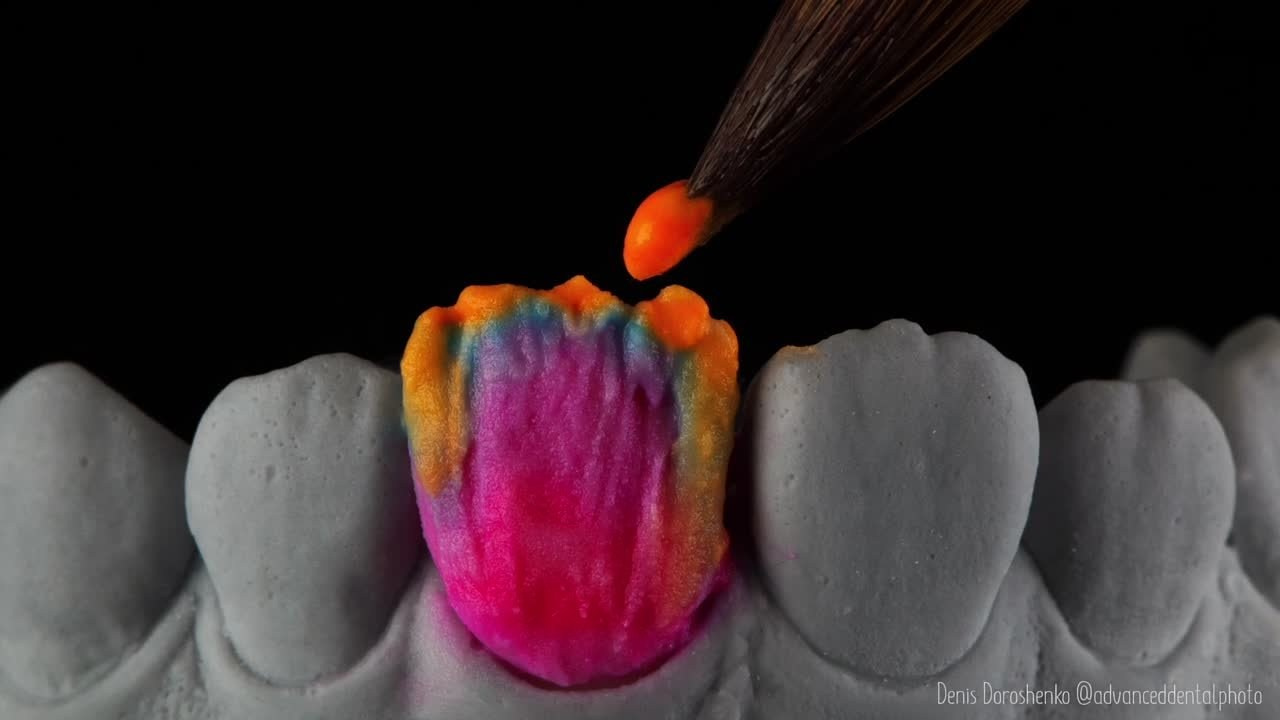 Арт. Дентал фотограф — видеограф Денис Дорошенко