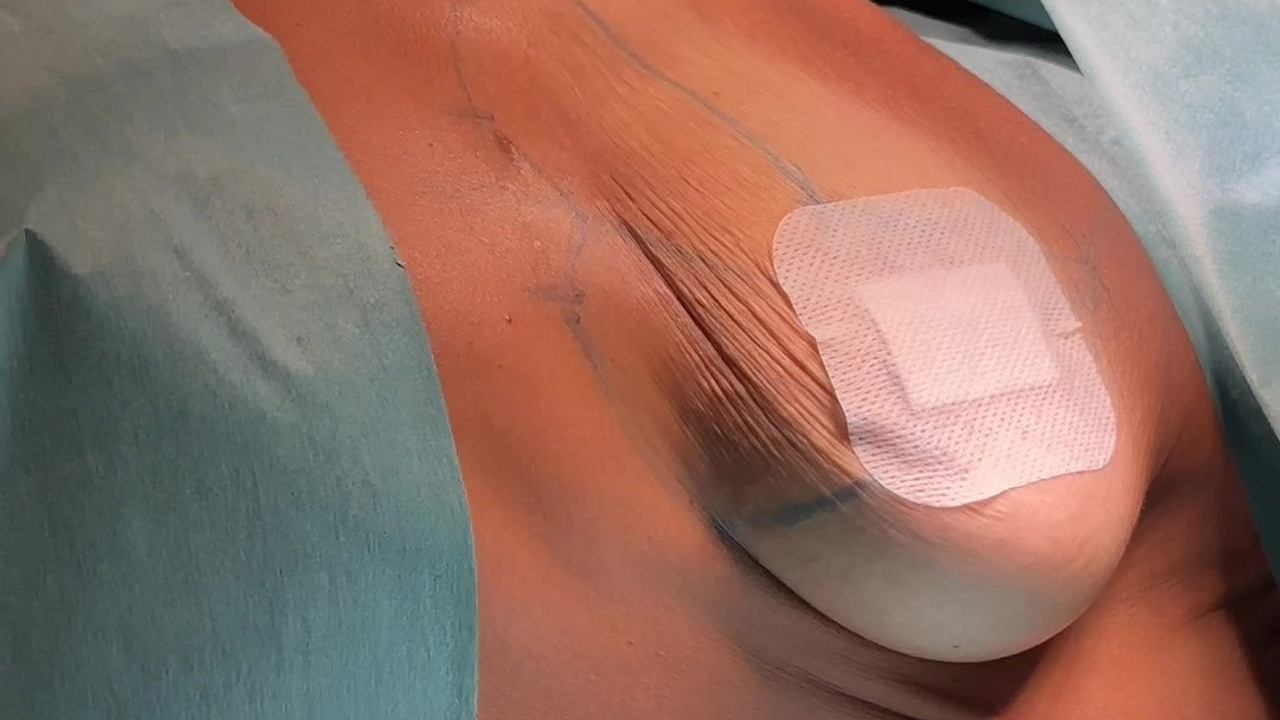 Пластическая хиругия. Видеоконтент для ваших соцсетей