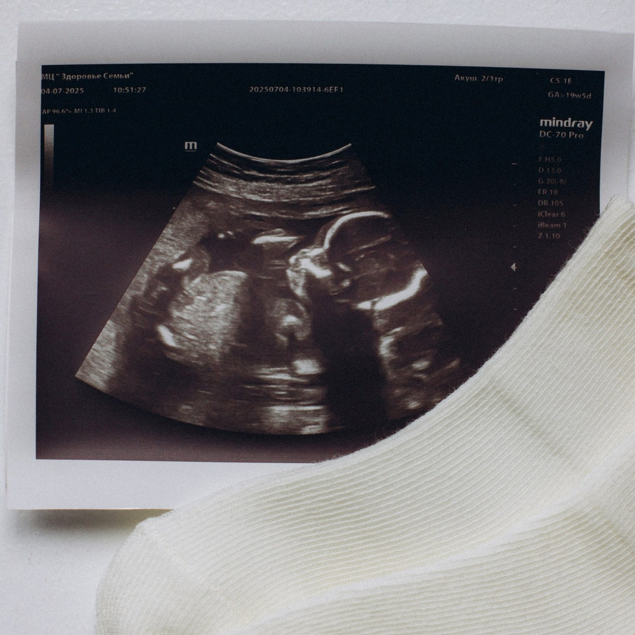 Отзывы. Фотограф в Зато Озёрном и Тверской области