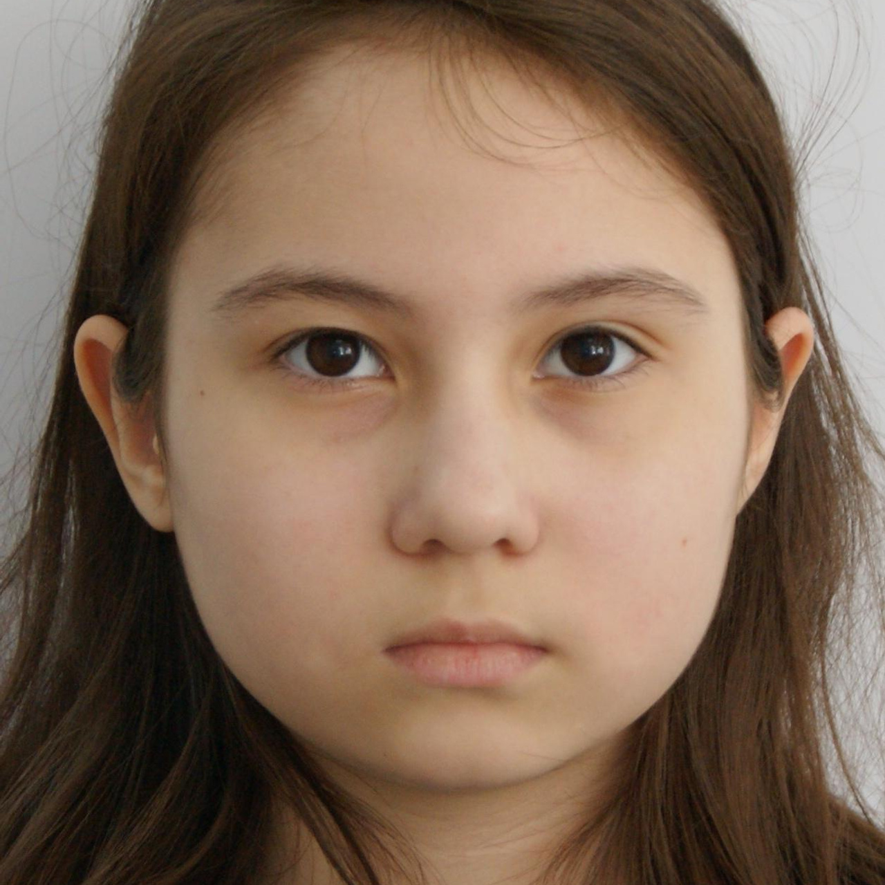 Отзывы о работе. Стоматология «Ортодонт-Эстетик». Установка брекетов в Оренбурге, взрос