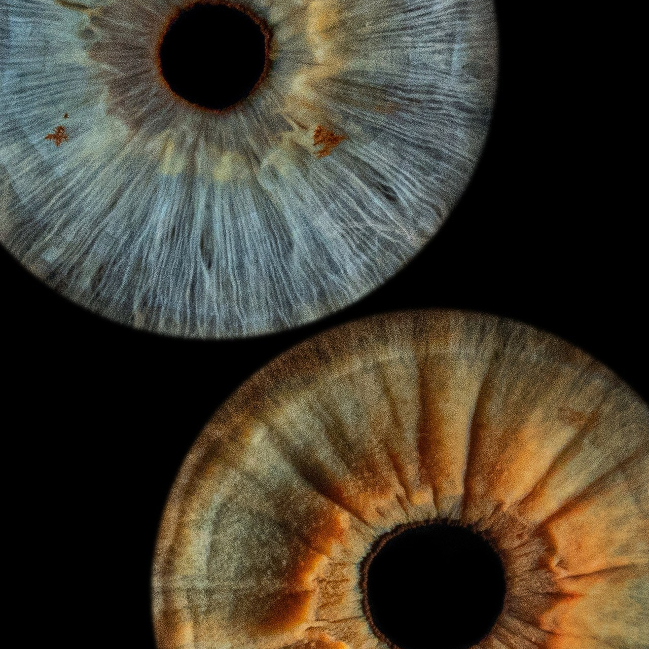 Отзывы. Мой глаз