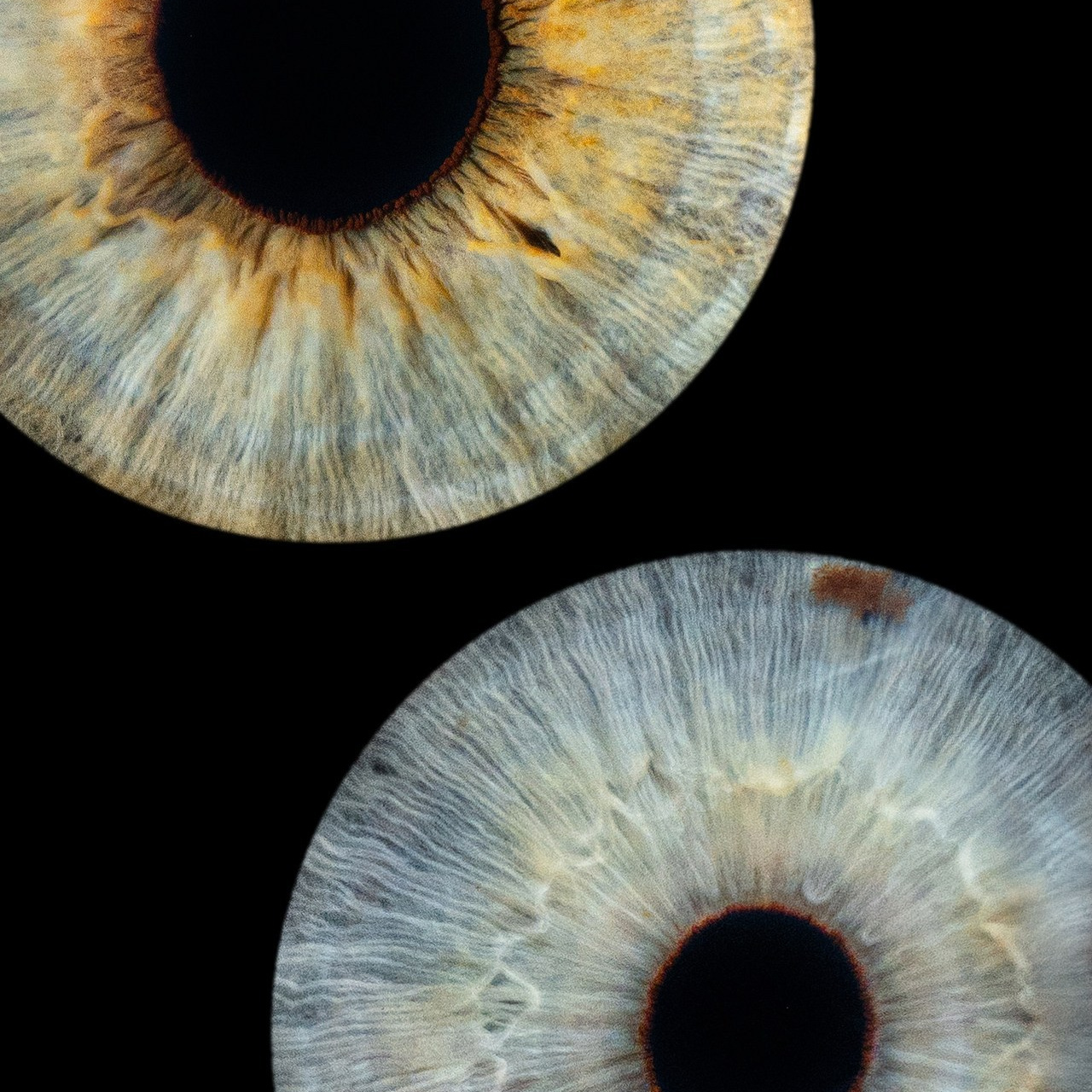 Отзывы. Мой глаз