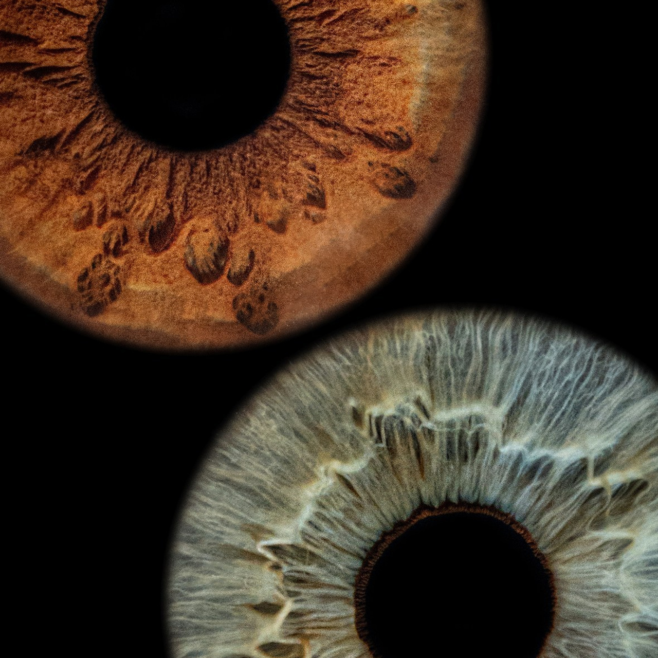 Отзывы. Мой глаз