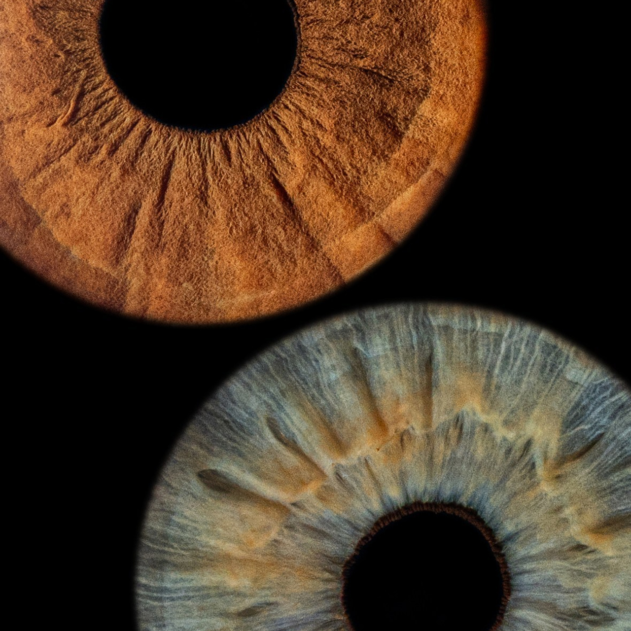 Отзывы. Мой глаз