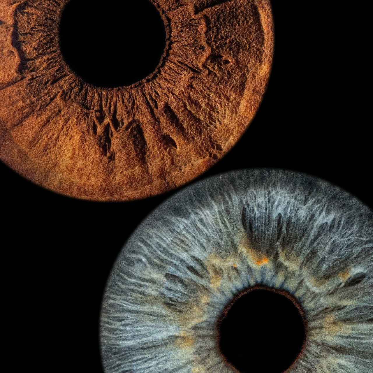 Отзывы. Мой глаз