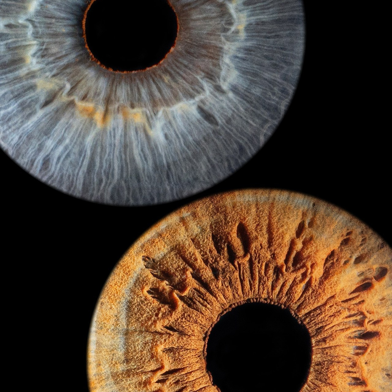 Отзывы. Мой глаз