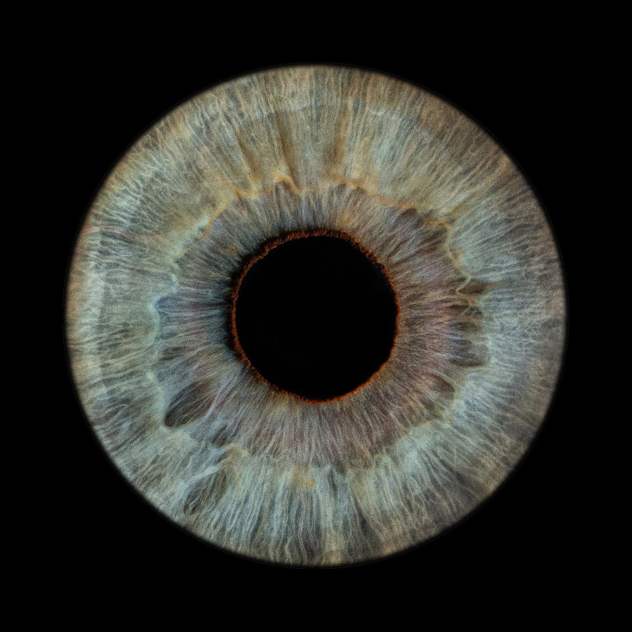 Отзывы. Мой глаз