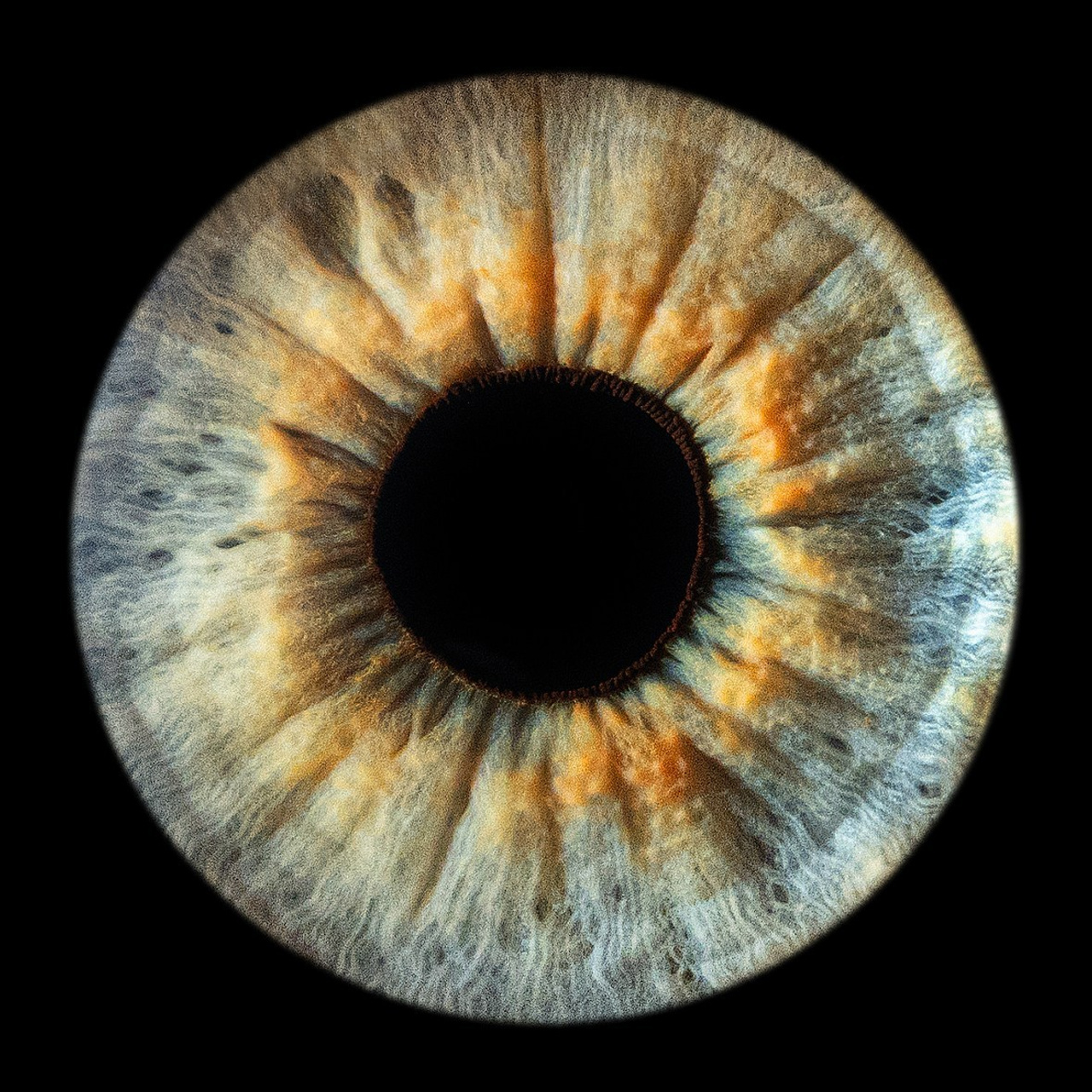 Отзывы. Мой глаз