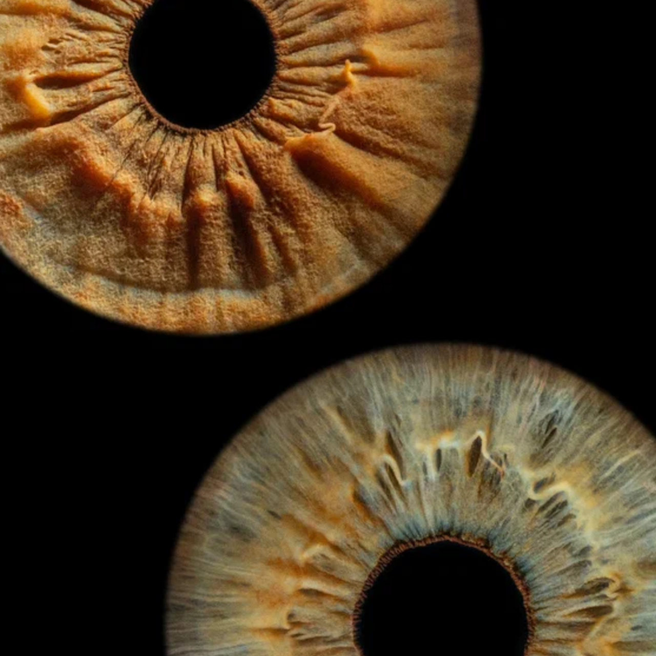 Отзывы. Мой глаз