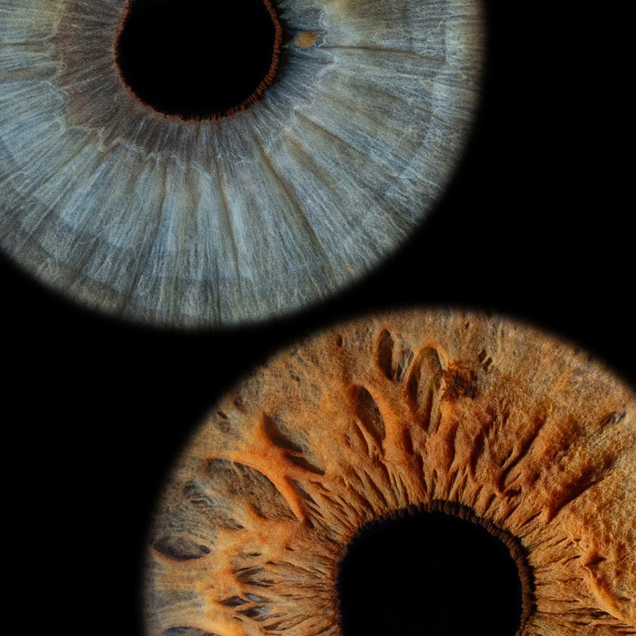 Отзывы. Мой глаз