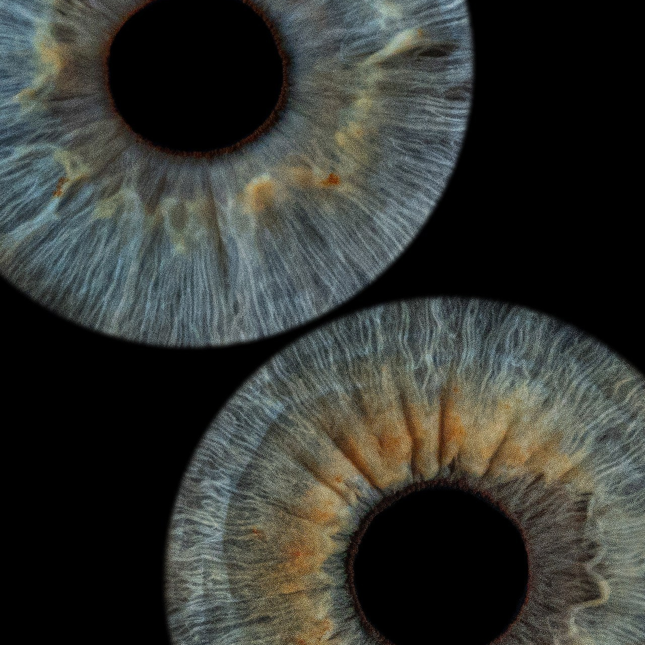 Отзывы. Мой глаз