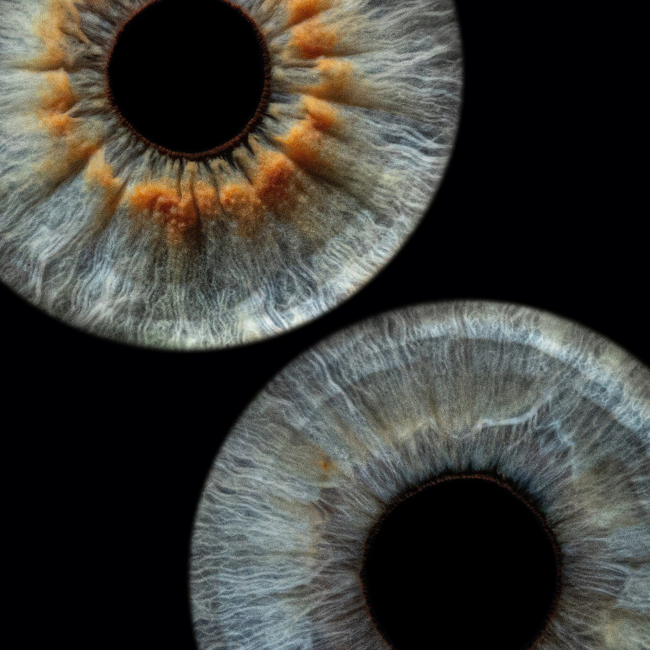 Отзывы. Мой глаз