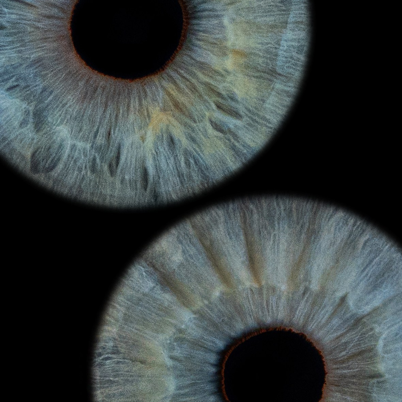 Отзывы. Мой глаз