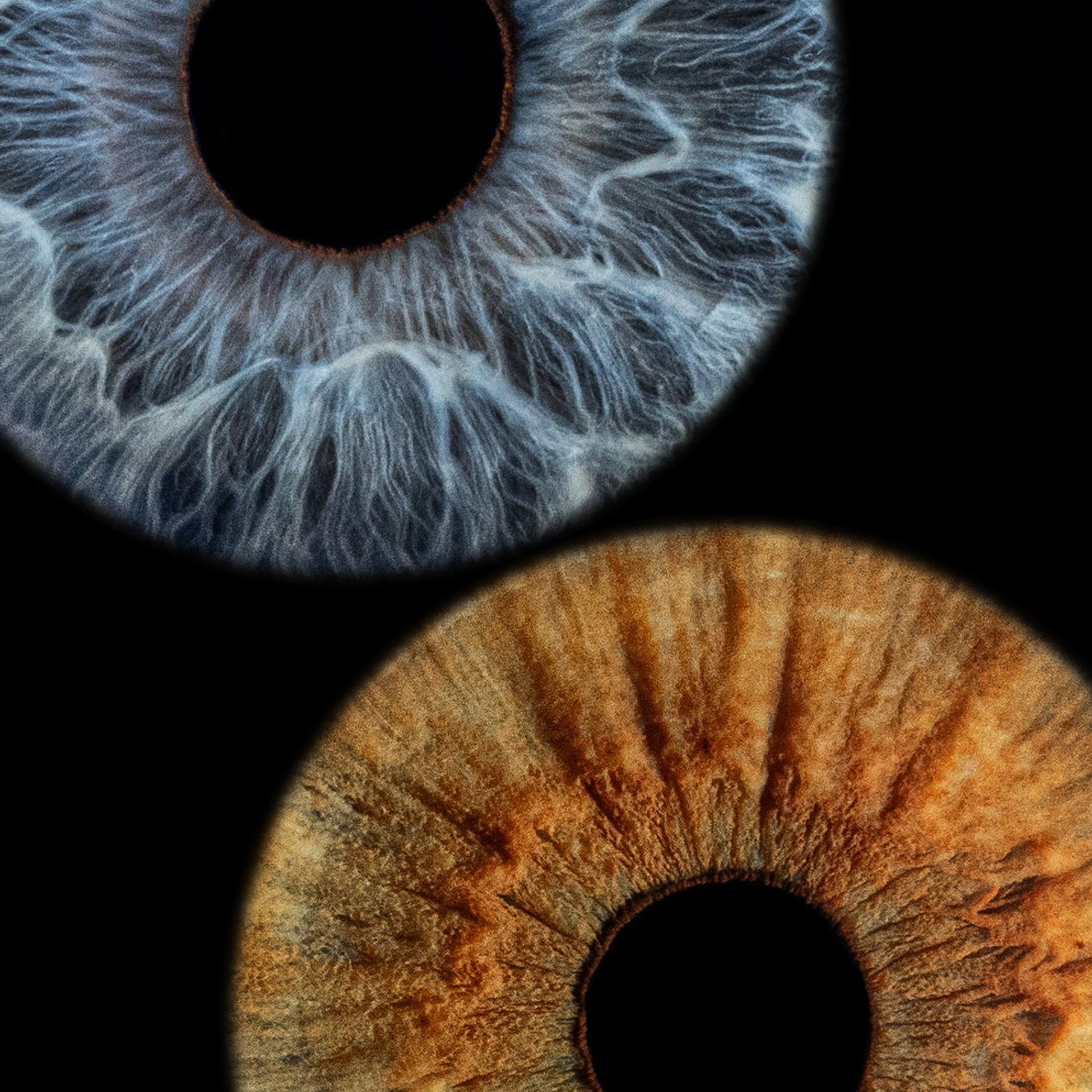 Отзывы. Мой глаз