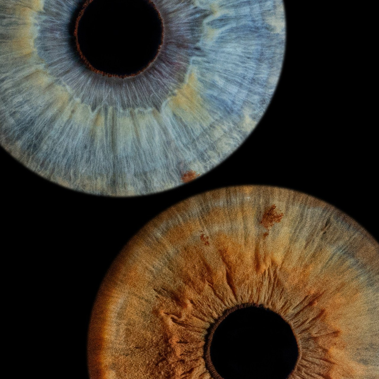 Отзывы. Мой глаз