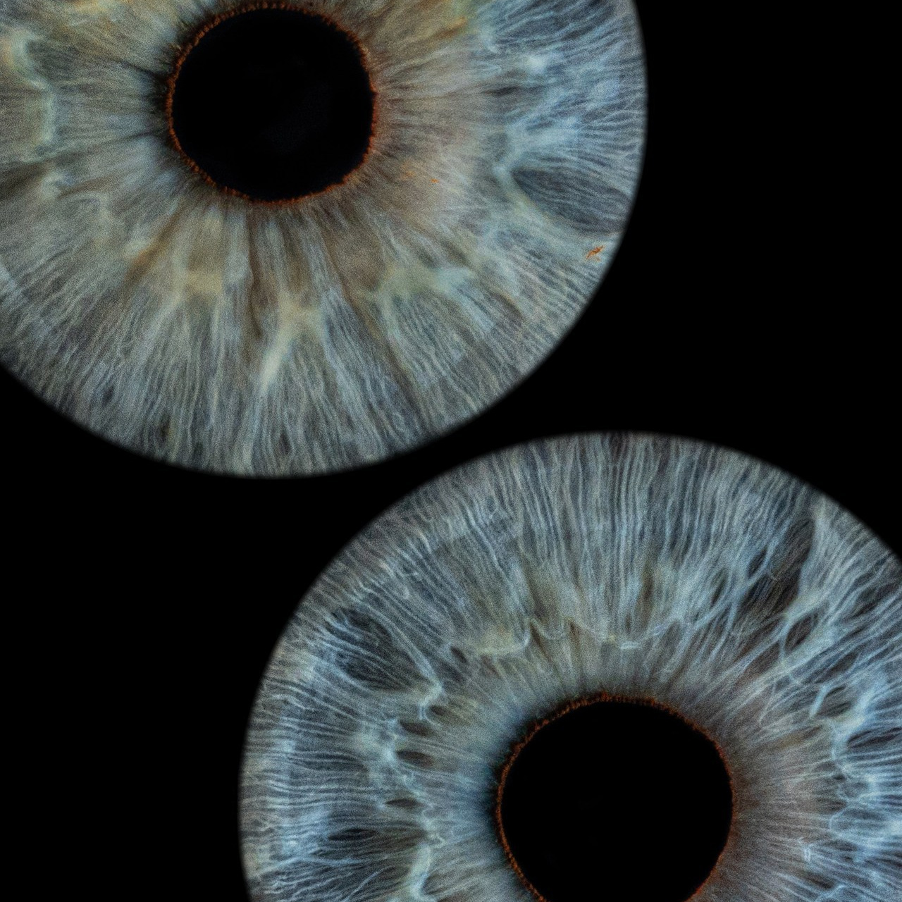 Отзывы. Мой глаз