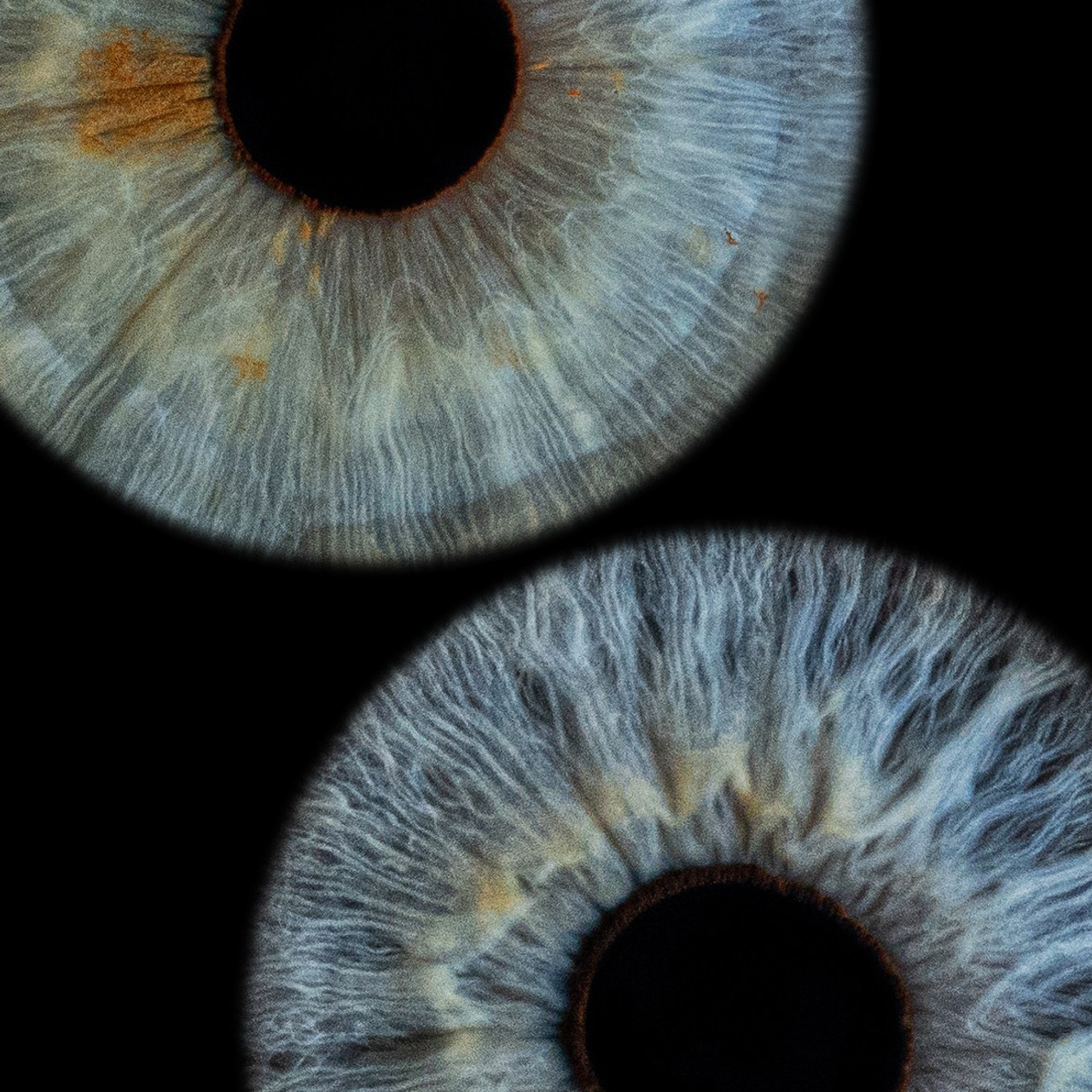 Отзывы. Мой глаз