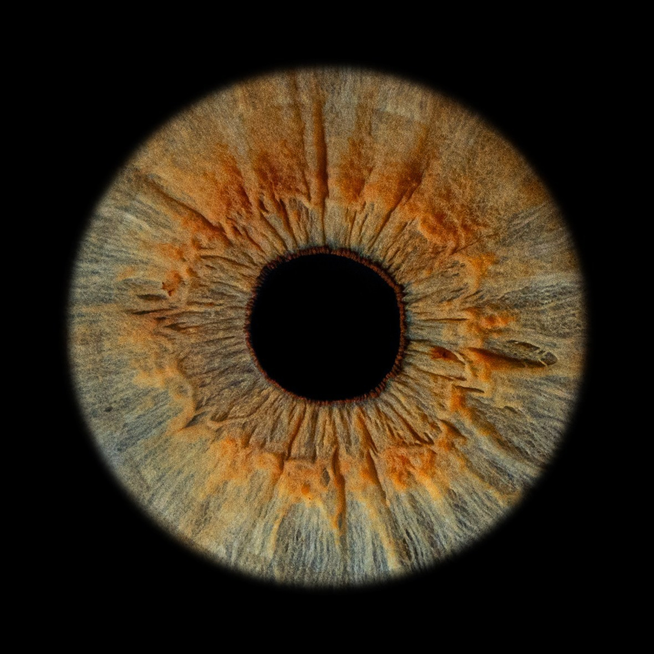 Отзывы. Мой глаз