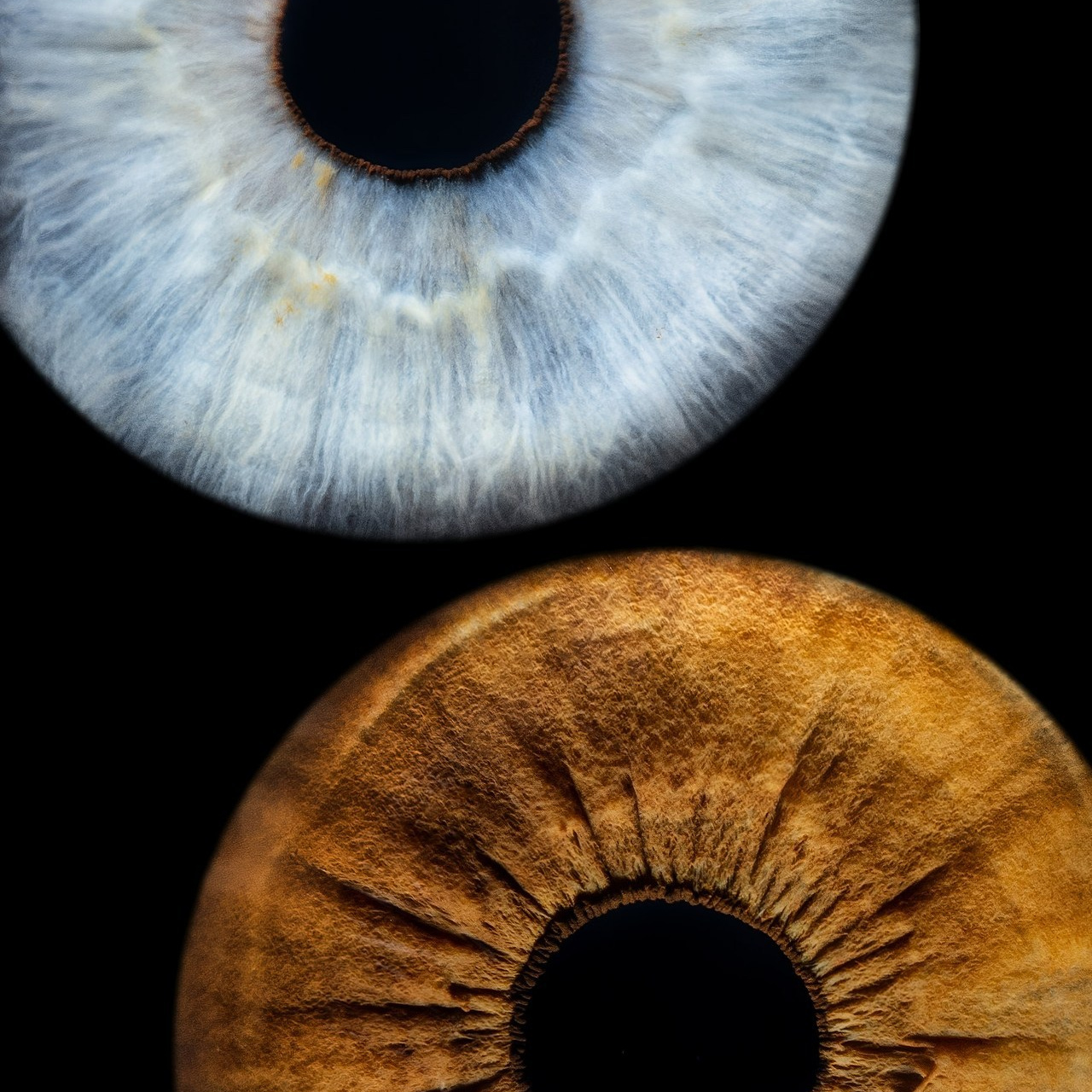 Отзывы. Мой глаз