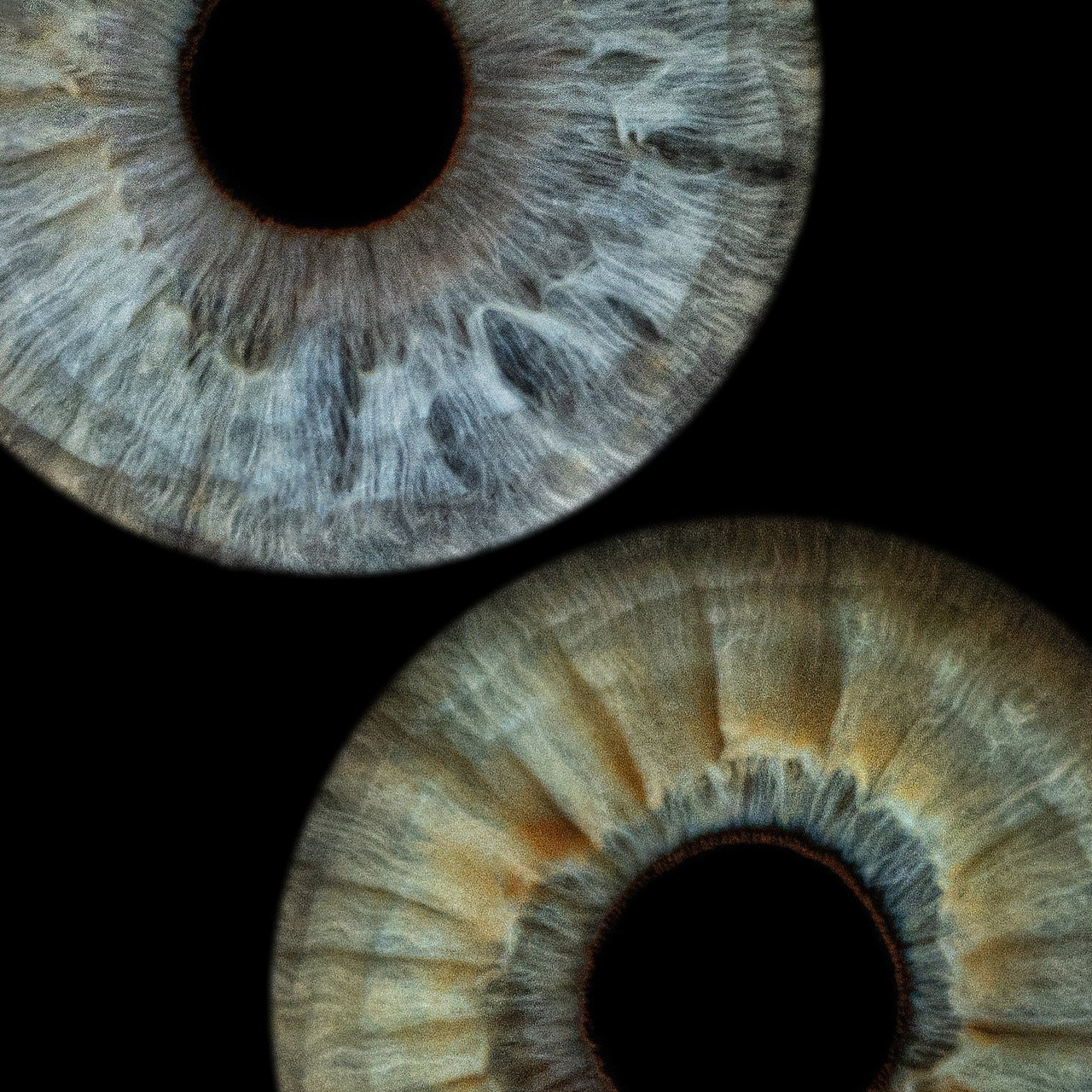 Отзывы. Мой глаз