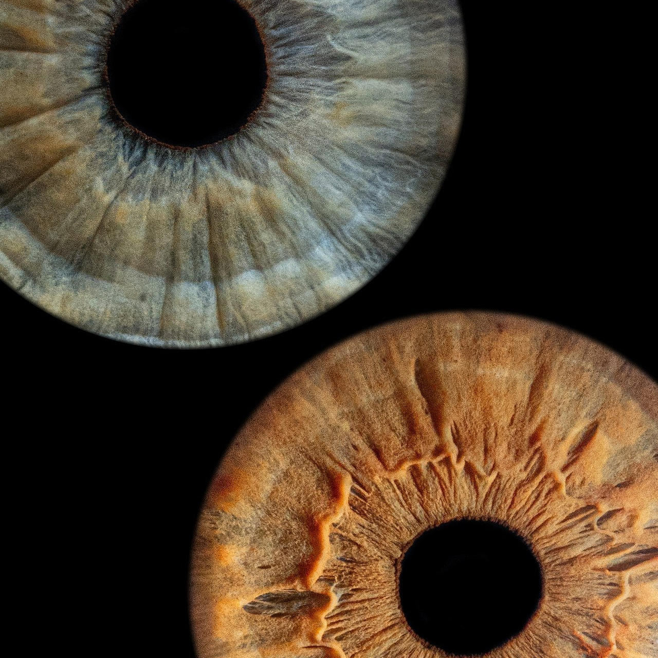 Отзывы. Мой глаз