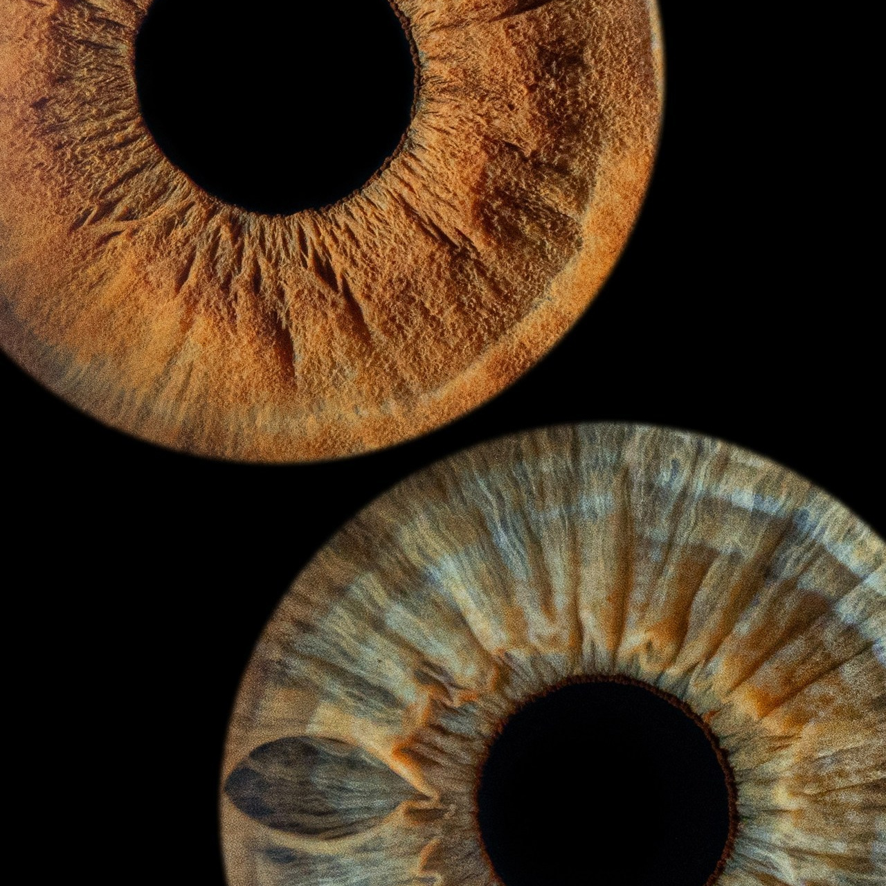 Отзывы. Мой глаз