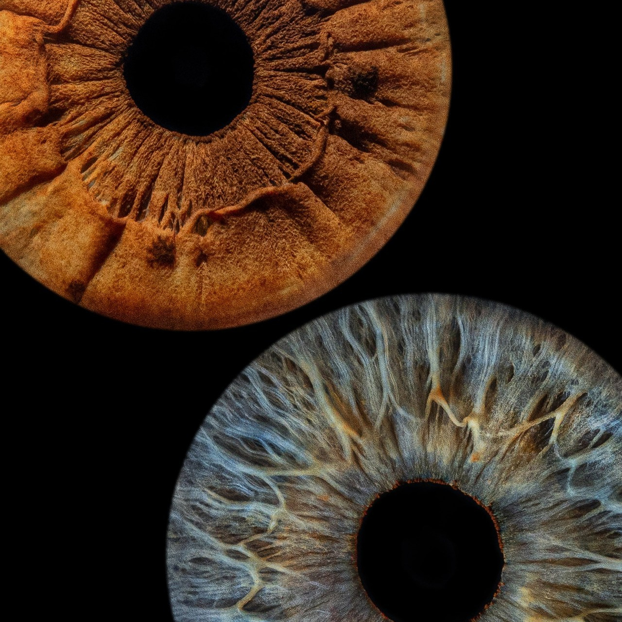 Отзывы. Мой глаз