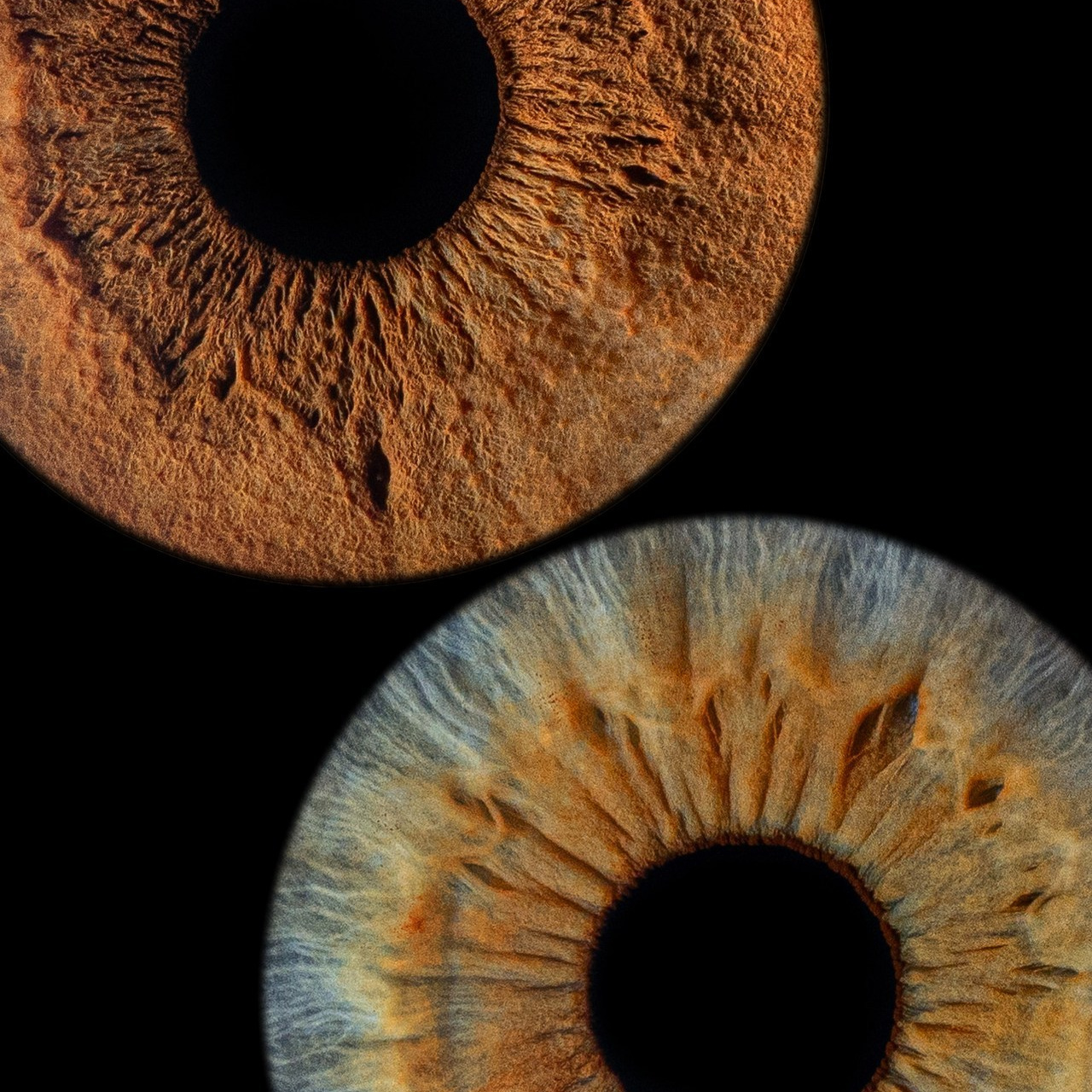 Отзывы. Мой глаз