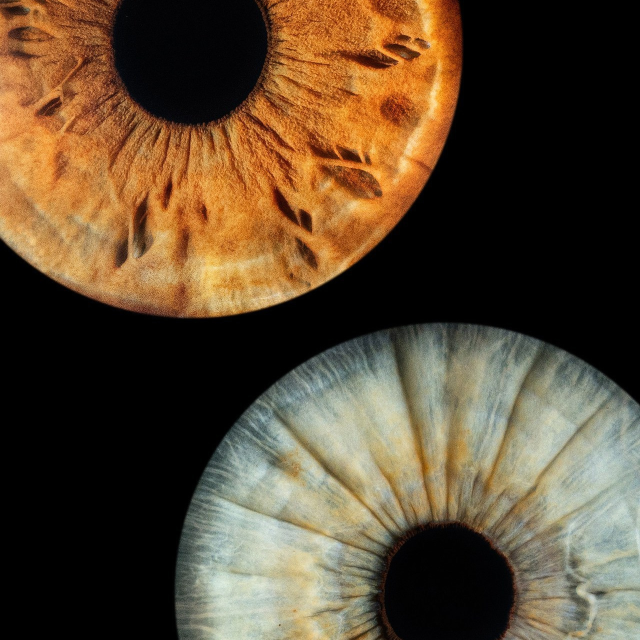 Отзывы. Мой глаз