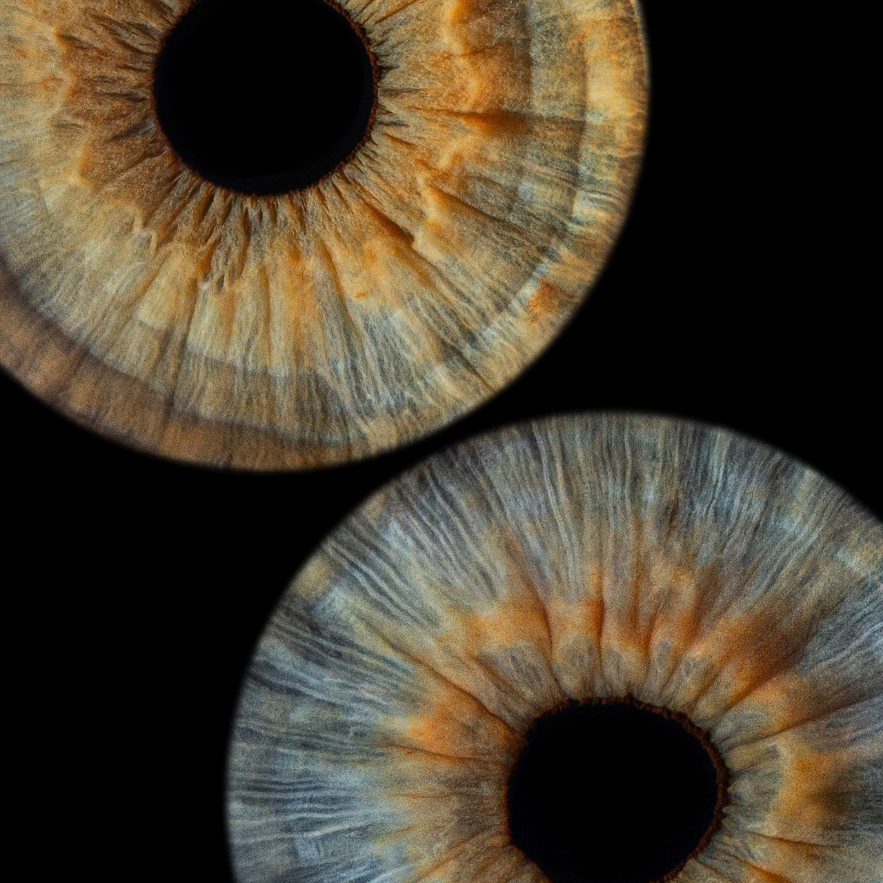 Отзывы. Мой глаз