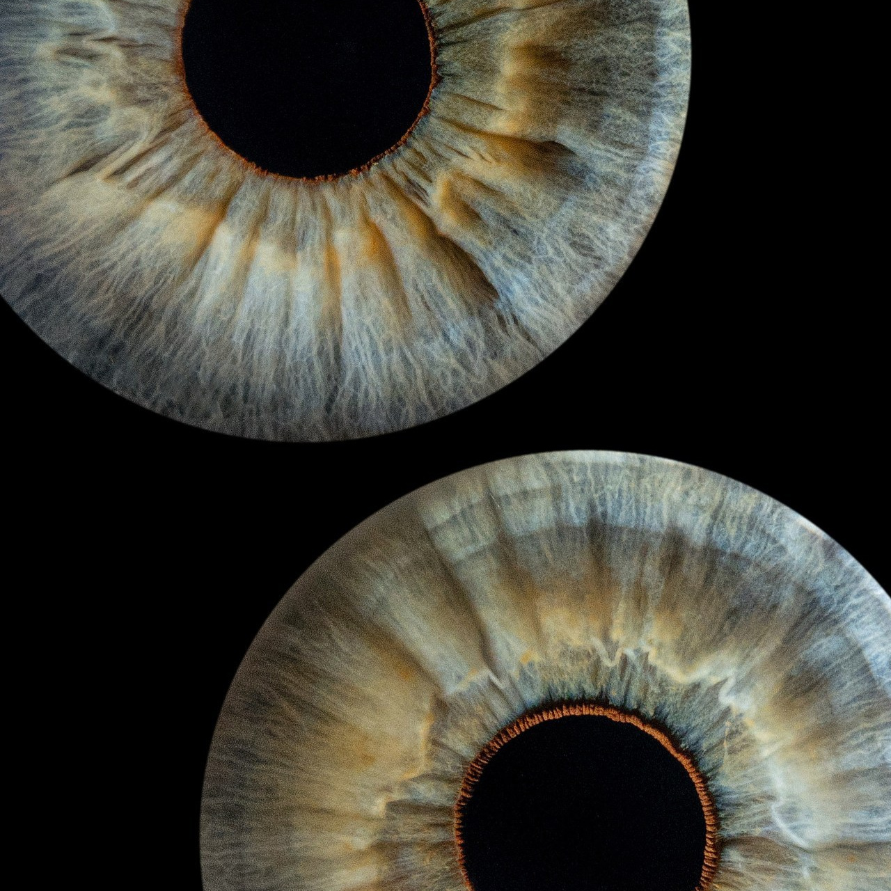 Отзывы. Мой глаз