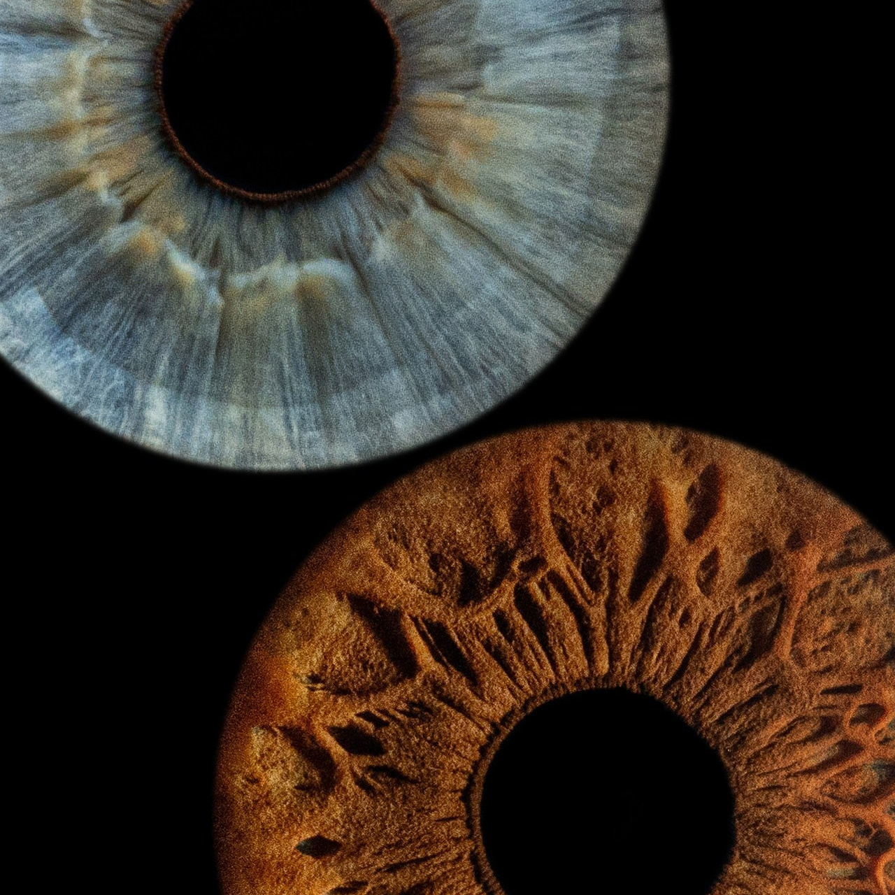 Отзывы. Мой глаз