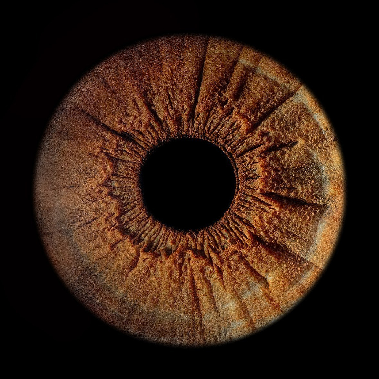 Отзывы. Мой глаз