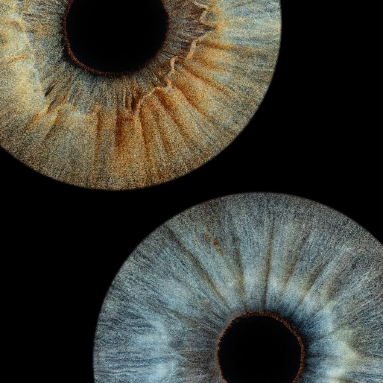 Отзывы. Мой глаз