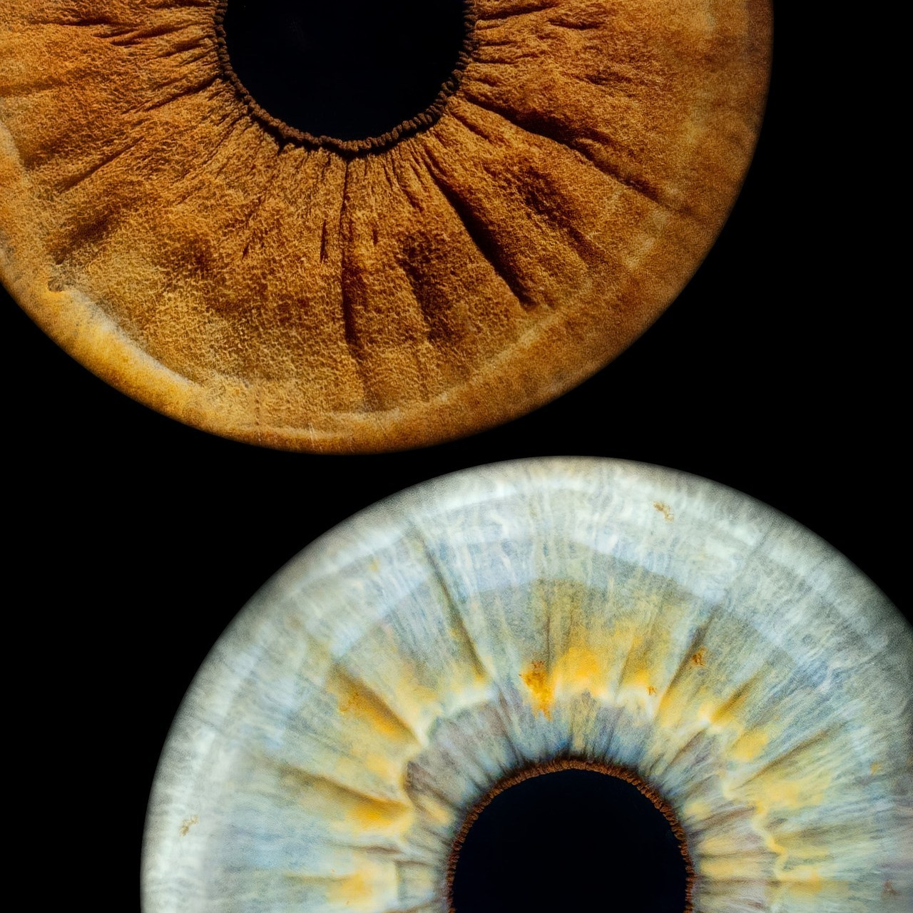 Отзывы. Мой глаз