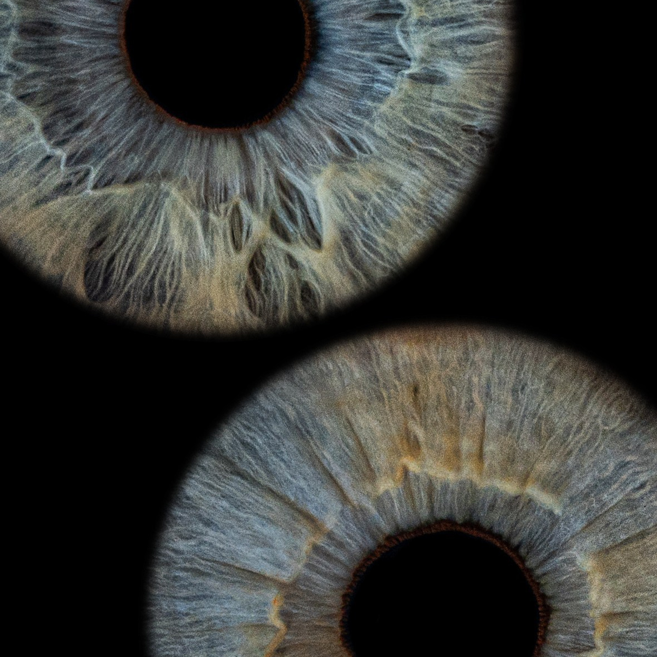 Отзывы. Мой глаз