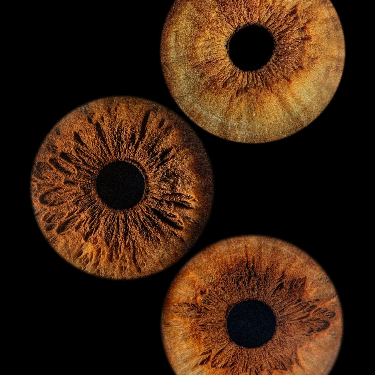 Отзывы. Мой глаз