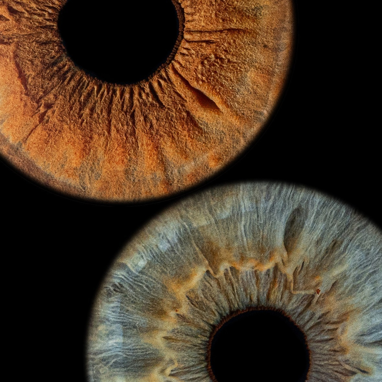 Отзывы. Мой глаз